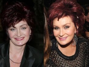 Sharon Osbourne before and after plastic surgery (15)