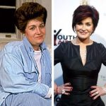 Sharon Osbourne before and after plastic surgery (2)