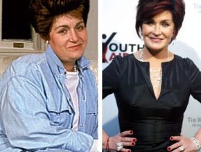 Sharon Osbourne before and after plastic surgery (2)