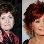 Sharon Osbourne before and after plastic surgery (22)