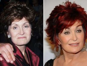 Sharon Osbourne before and after plastic surgery (22)