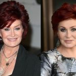 Sharon Osbourne before and after plastic surgery (23)