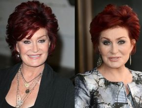 Sharon Osbourne before and after plastic surgery (23)