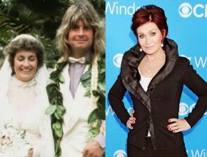 Sharon Osbourne before and after plastic surgery