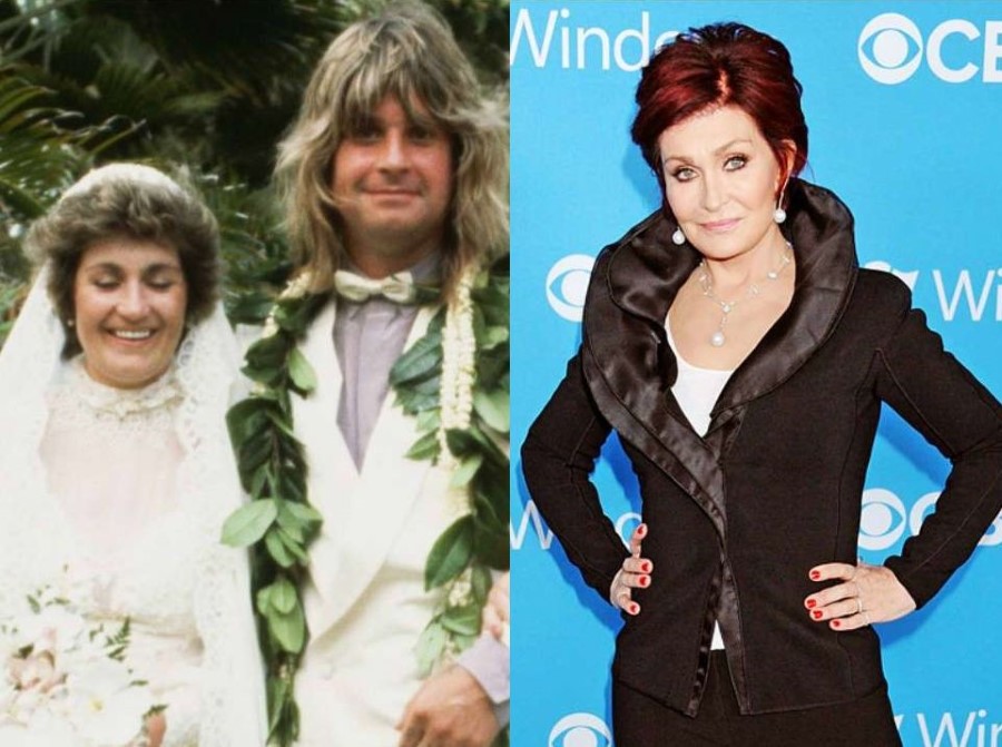 Sharon Osbourne before and after plastic surgery