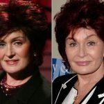 Sharon Osbourne before and after plastic surgery (44)