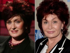 Sharon Osbourne before and after plastic surgery (44)