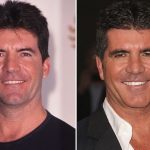 Simon Cowell before and after plastic surgery (26)