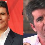 Simon Cowell before and after plastic surgery (38)