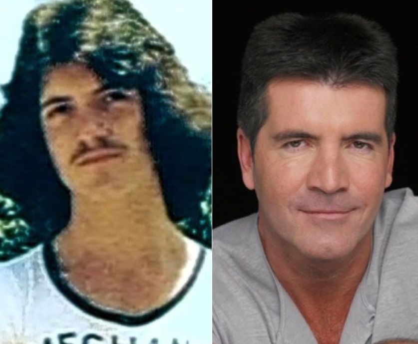 Simon Cowel before and after plastic surgery