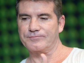 Simon Cowell plastic surgery (11)