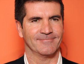 Simon Cowell plastic surgery (12)