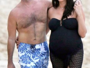 Simon Cowell plastic surgery (14)