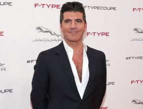 Simon Cowell plastic surgery (18)