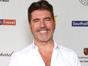 Simon Cowell plastic surgery (19)