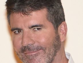 Simon Cowell plastic surgery (22)