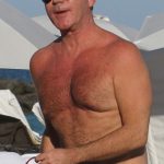 Simon Cowell plastic surgery (25)