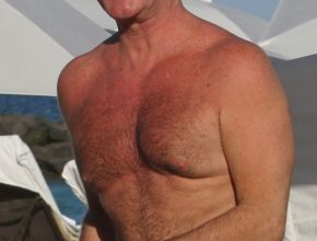 Simon Cowell plastic surgery (25)