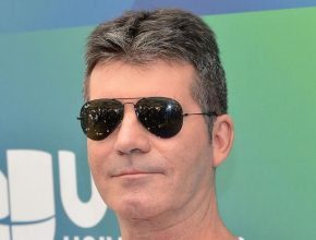 Simon Cowell plastic surgery (27)