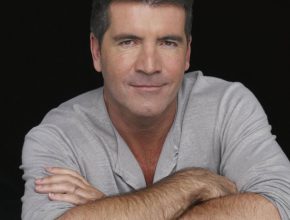 Simon Cowell plastic surgery (28)