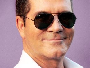 Simon Cowell plastic surgery (3)