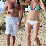 Simon Cowell plastic surgery (31)