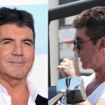 Simon Cowell plastic surgery (32)