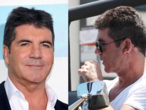 Simon Cowell plastic surgery (32)