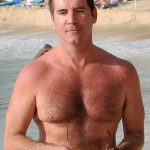 Simon Cowell plastic surgery (37)