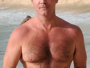 Simon Cowell plastic surgery (37)