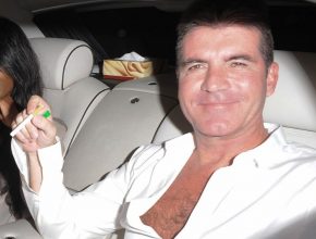 Simon Cowell plastic surgery (39)