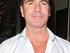 Simon Cowell plastic surgery (40)