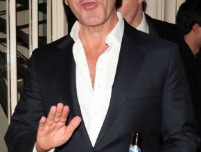 Simon Cowell plastic surgery (41)