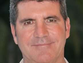 Simon Cowell plastic surgery (43)