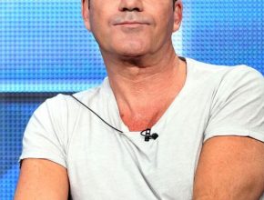 Simon Cowell plastic surgery (6)