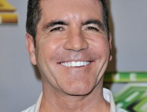 Simon Cowell plastic surgery (7)