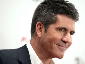 Simon Cowell plastic surgery (8)