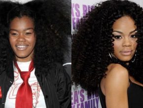 Teyana Taylor before and after plastic surgery (19)