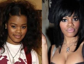 Teyana Taylor before and after plastic surgery (20)