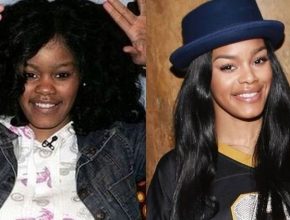 Teyana Taylor before and after plastic surgery (28)
