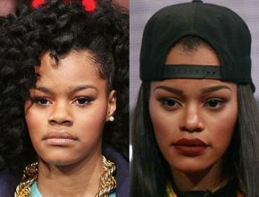 Teyana Taylor before and after plastic surgery