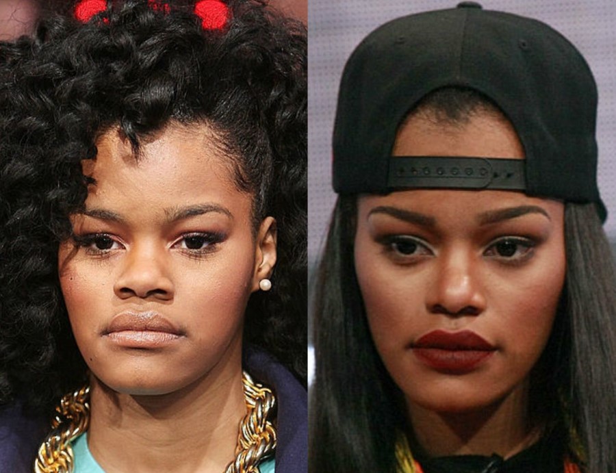 Teyana Taylor before and after plastic surgery