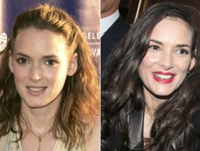 Winona Ryder before and after plastic surgery