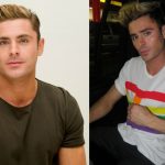 Zac Efron before and after plastic surgery (12)