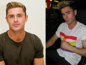 Zac Efron before and after plastic surgery (12)