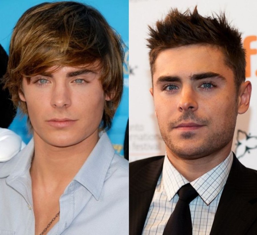 Zac Efron before and after plastic surgery