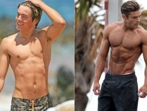 Zac Efron before and after plastic surgery (30)