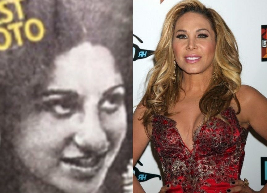 Adrienne Maloof before and afterplastic surgery