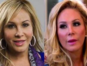 Adrienne Maloof before and afterplastic surgery (40)