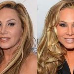 Adrienne Maloof before and afterplastic surgery (41)